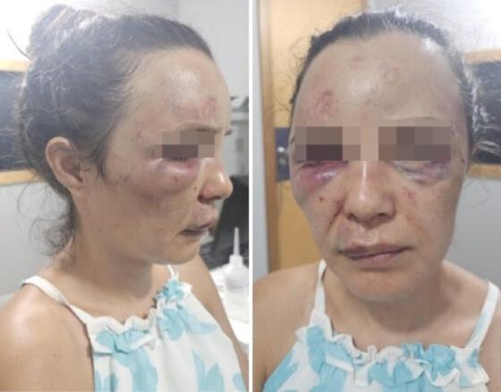 Suellen foi amarrada e sofreu diversas agressões físicas como socos e chutes que atingiram o rosto e várias partes do corpo