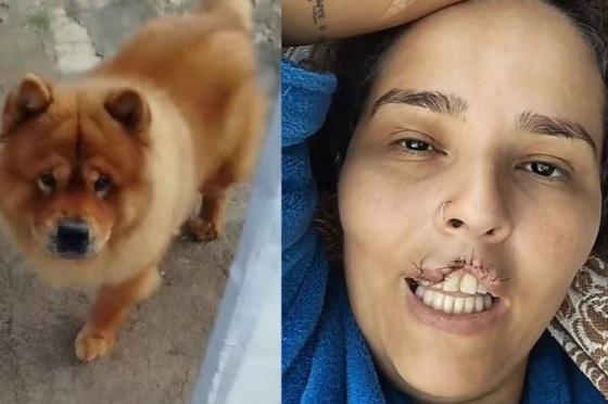 Mulher precisou de atendimento médico e aguarda cirurgia de reconstrução facial