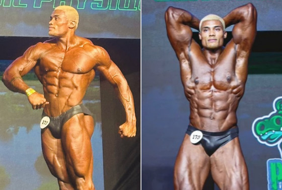 Wanderson sofreu uma parada cardíaca logo após a sua apresentação no evento.