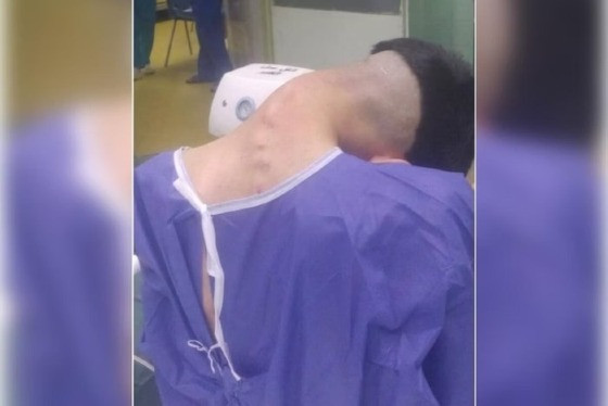 O caso, registrado no Hospital Universitário Al-Zahra, no Irã, foi publicado em abril, na revista Clinical Case Reports