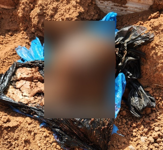 Cabeça ainda não estava em avançado estado de decomposição.