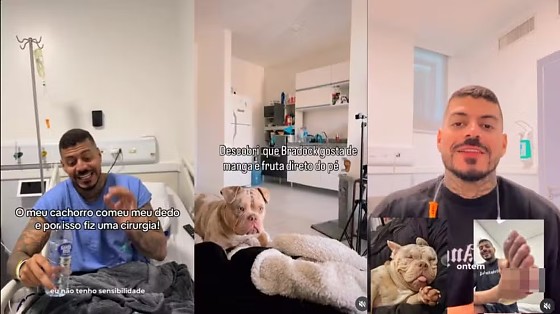 Influencidor de SC relata que cão comeu seu dedo