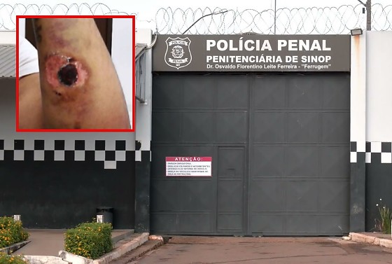 Fotos de tortura dos detentos constam no relatório elaborado pelo TJMT