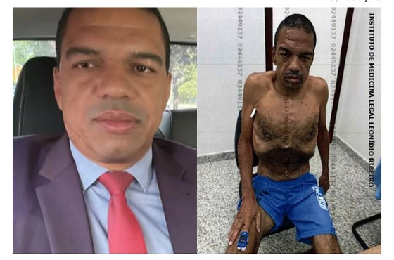 Uma foto da perícia divulgada à época mostrou o investigado em estado esquelético