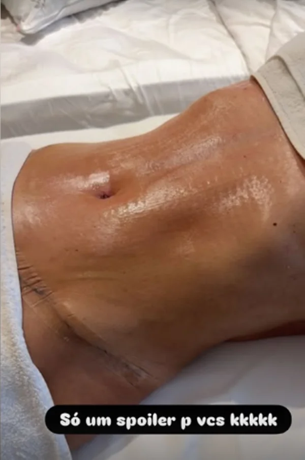 Mãe de Virginia impressiona ao mostrar resultado de cirurgia plástica - destaque galeria