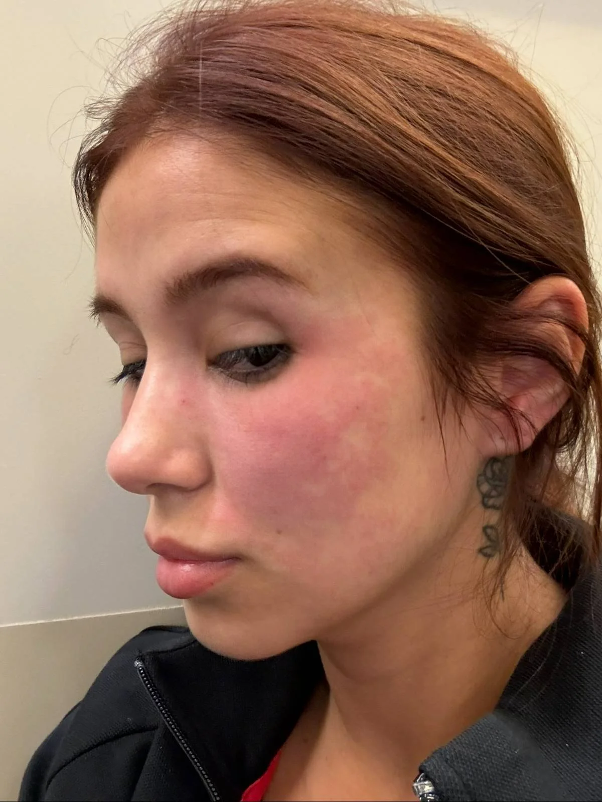 Ainda de acordo com a nota assinada pelo advogado Eduardo Maurício, o profissional responsável pelo procedimento de Tavares foi desligado do estabelecimento