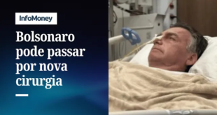 Bolsonaro reclama de 'dor intermitente' no ombro e PGR não se opõe à cirurgia