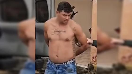Uma mulher teve a mão decepada com foice